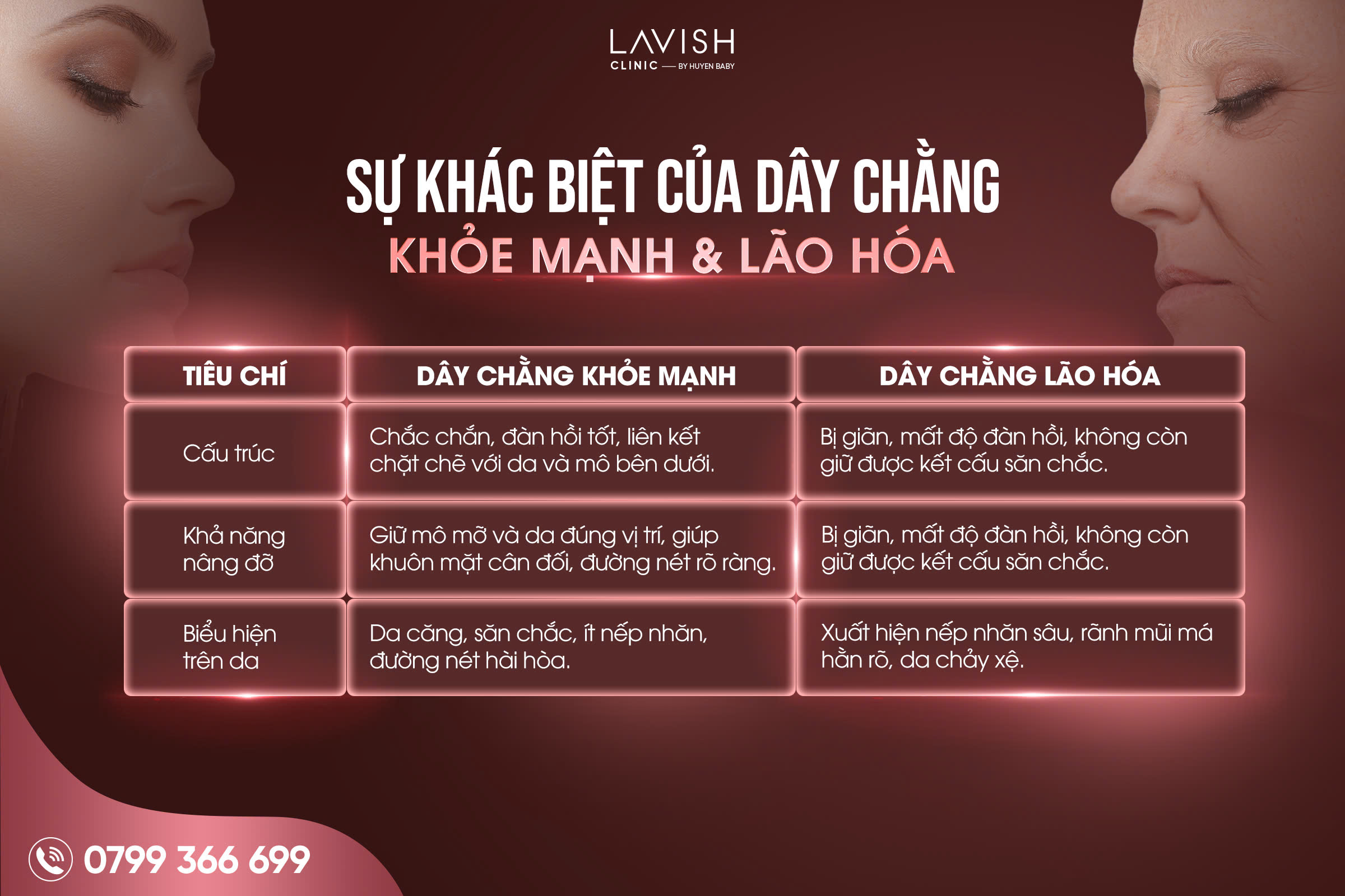 trẻ hóa dây chằng lavish clinic
