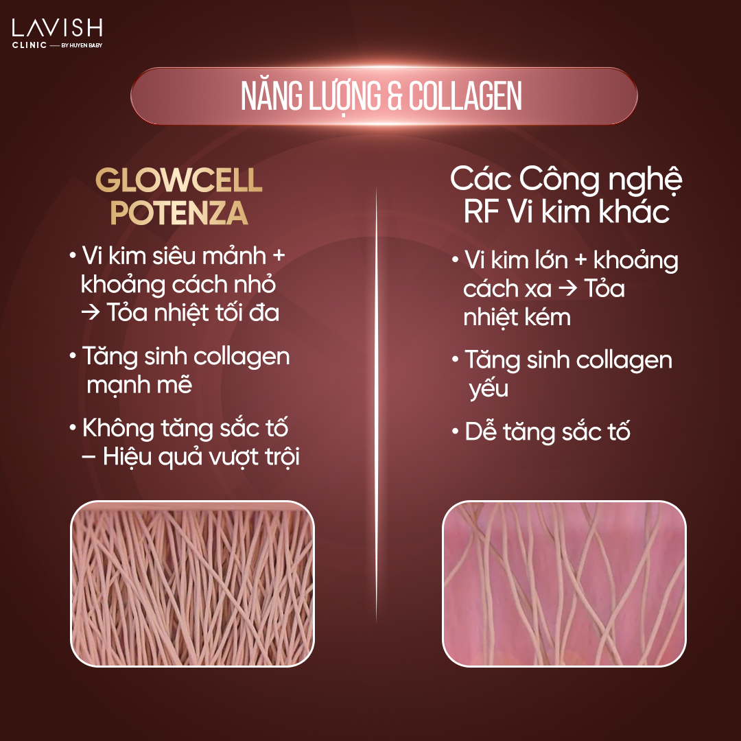 Glowcell Potenza Lavish Clinic 