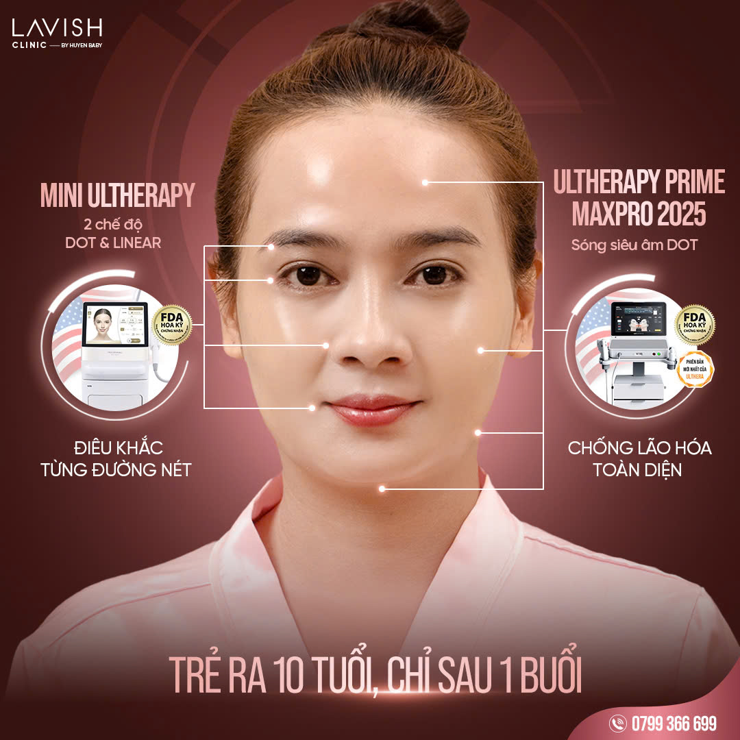 Công nghệ DOT và LINEAR lavish