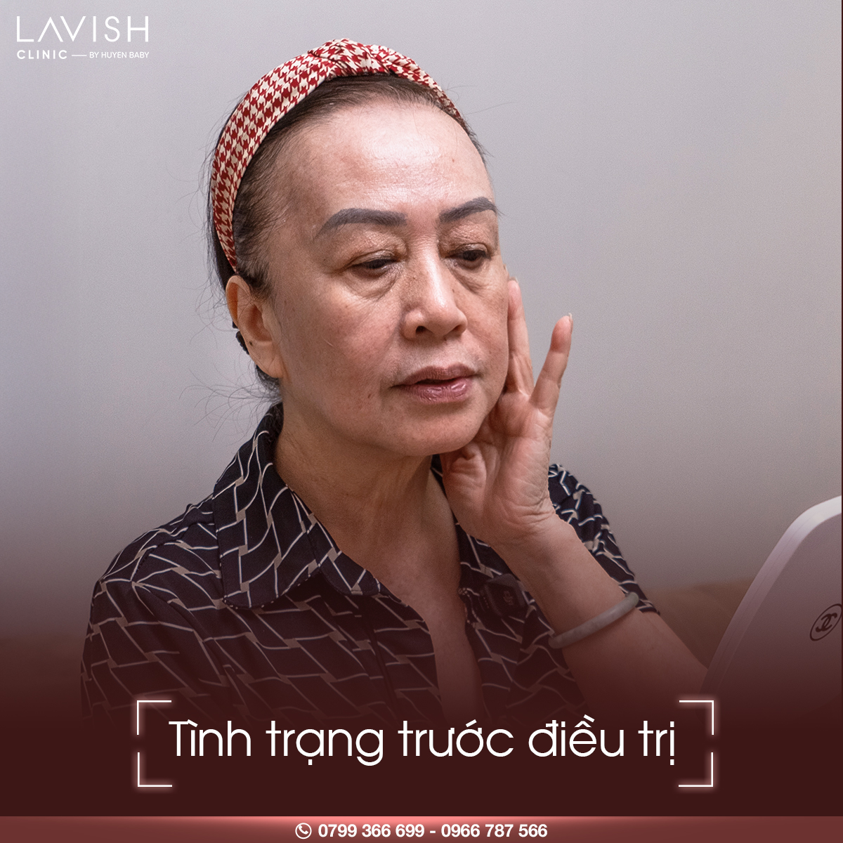 Phác đồ trẻ hóa đa tầng da