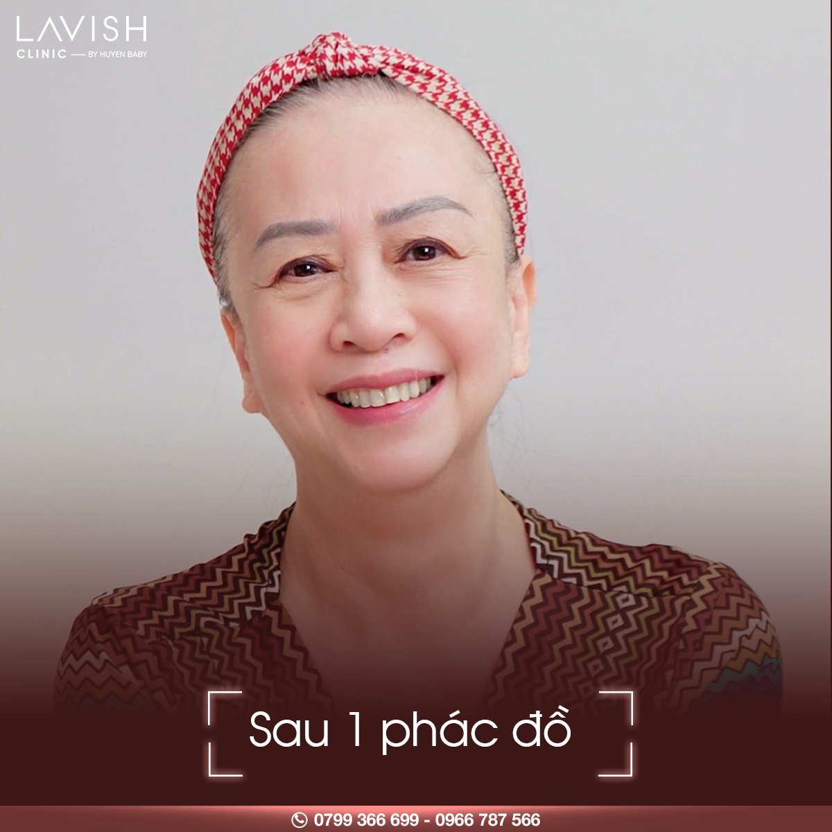 Phác đồ trẻ hóa đa tầng da