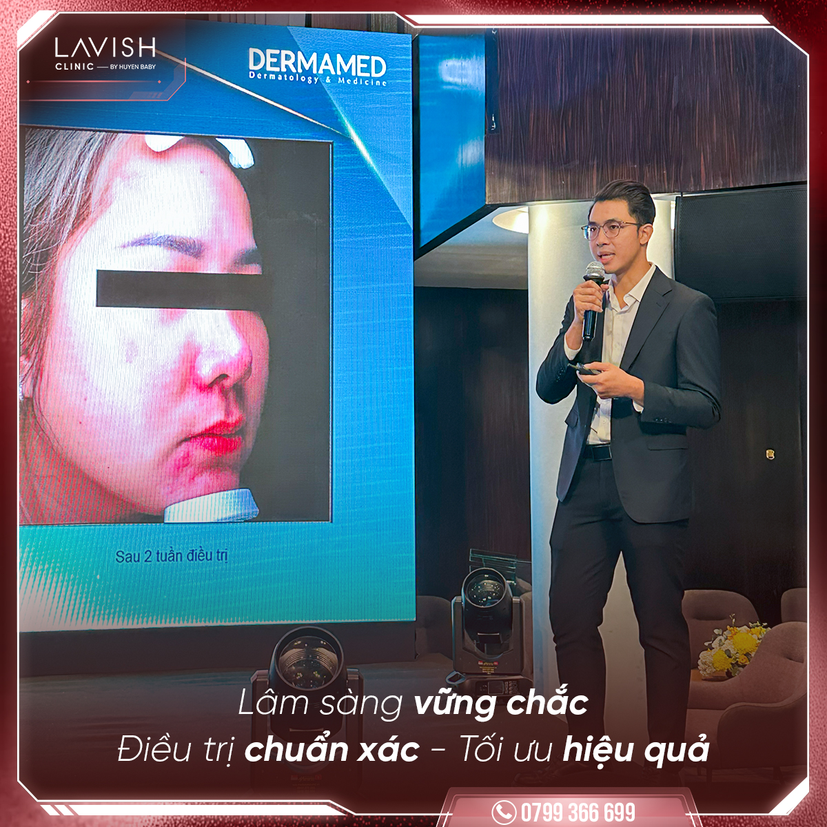 lavishclinic_sculptrix trẻ hóa 