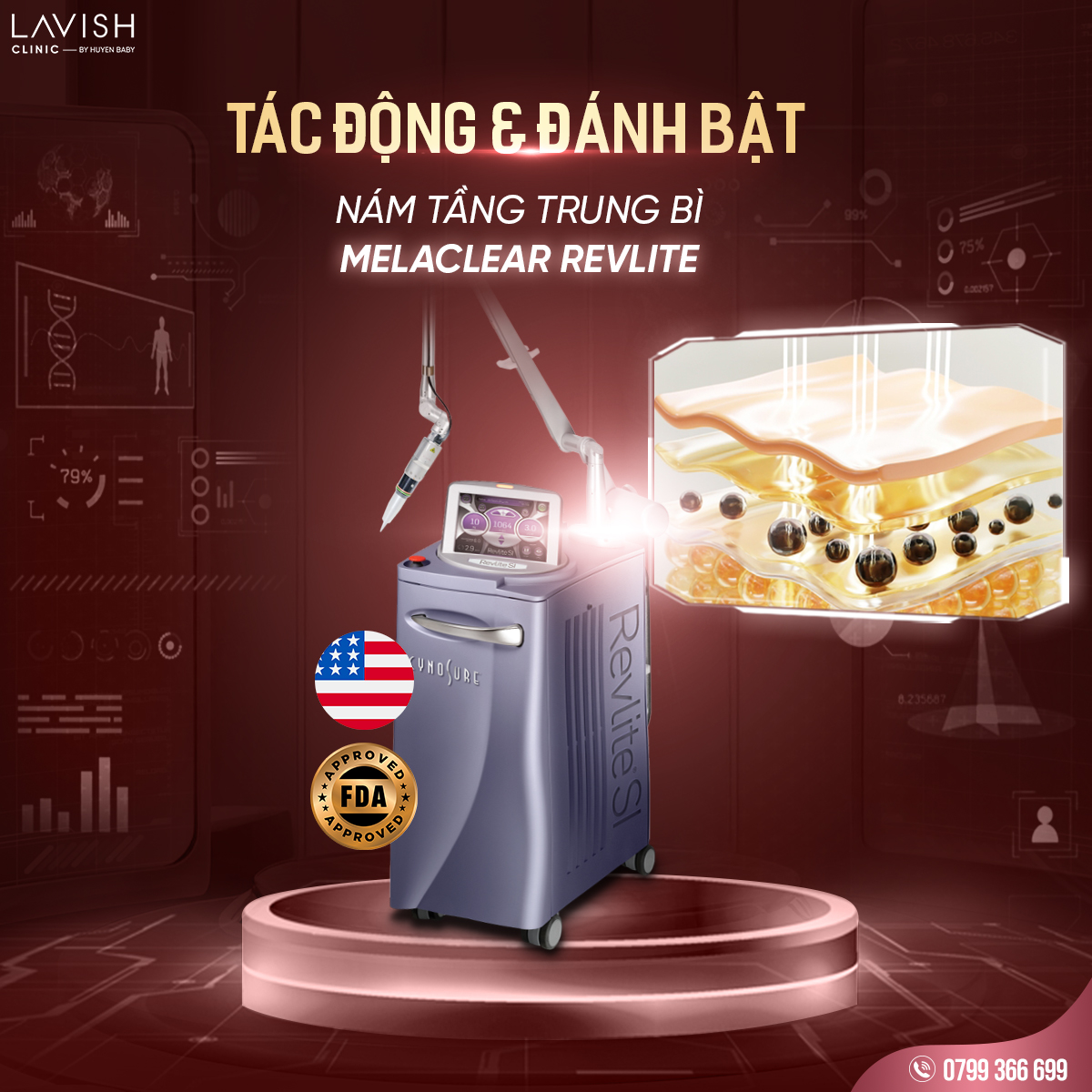 combo đặc trị nám Lavish Clinic