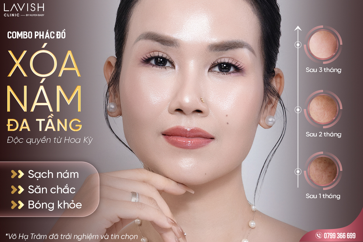 combo Alma Resurfx_Lavish Clinic