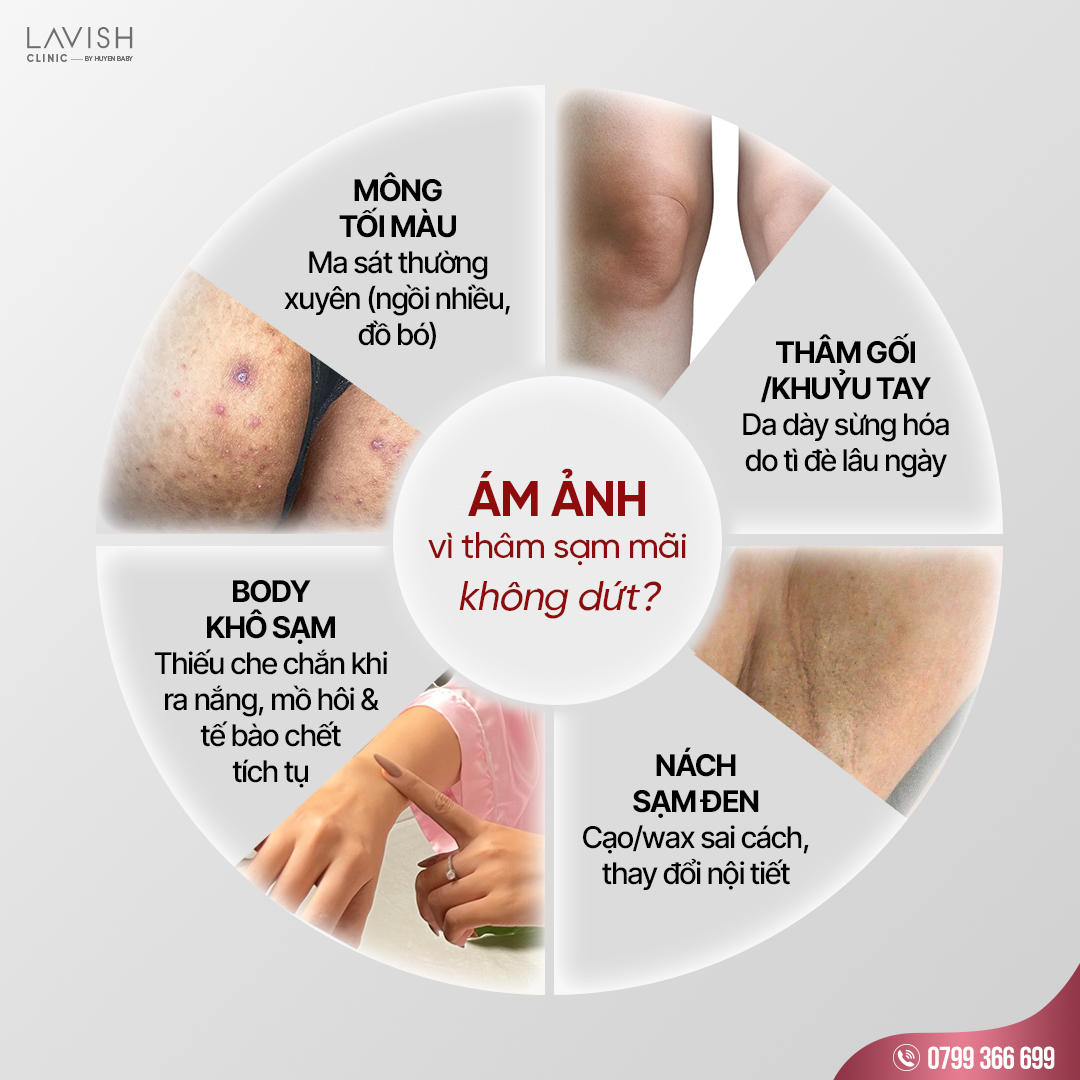 lavishclinic_tắm trắng pearl skin