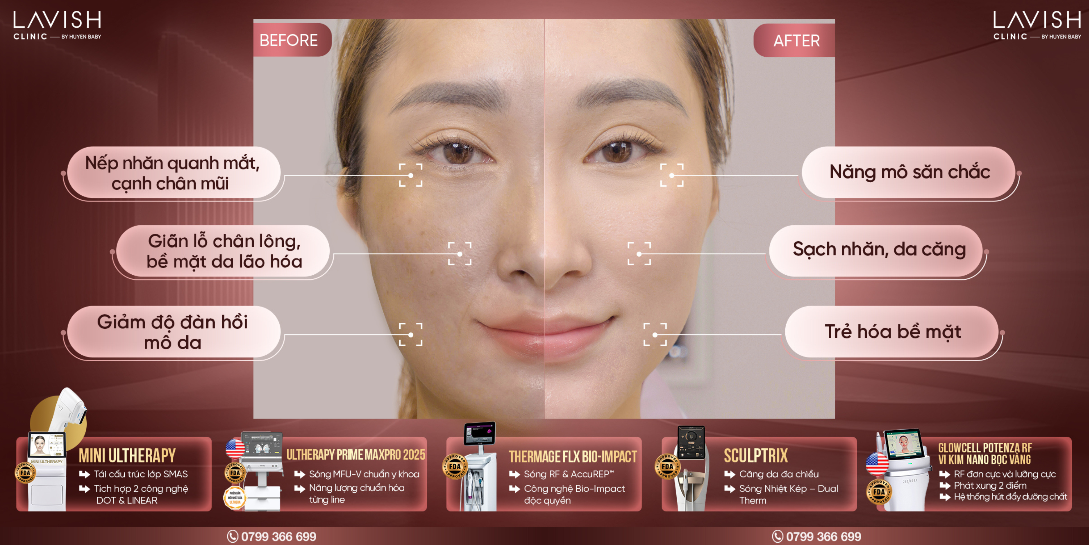 lavish clinic_ trẻ hóa đa tầng