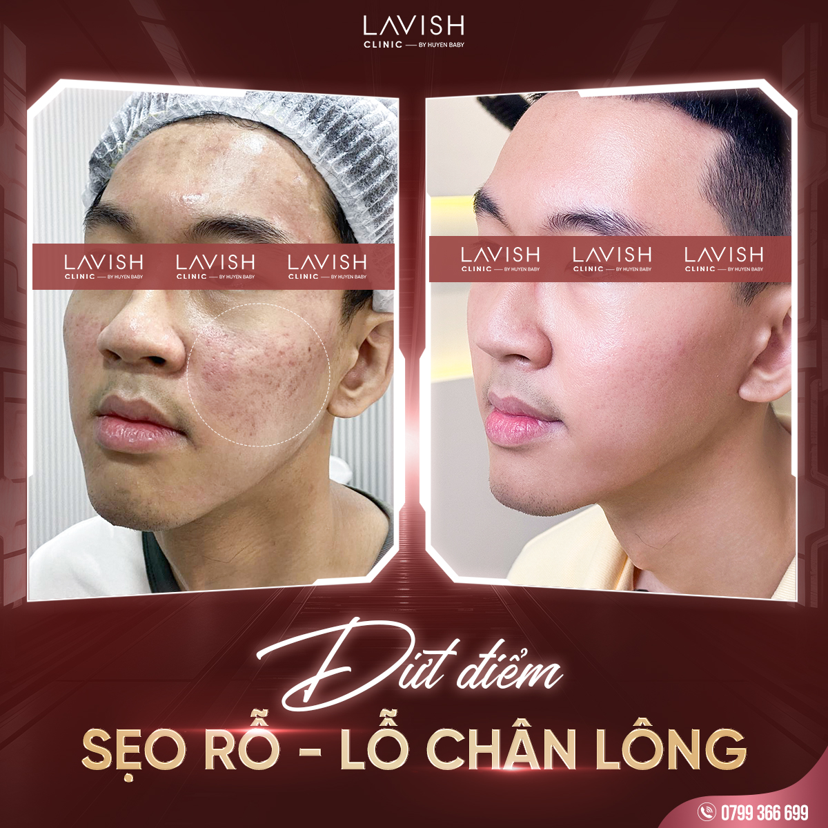 dieutriseolavishclinic