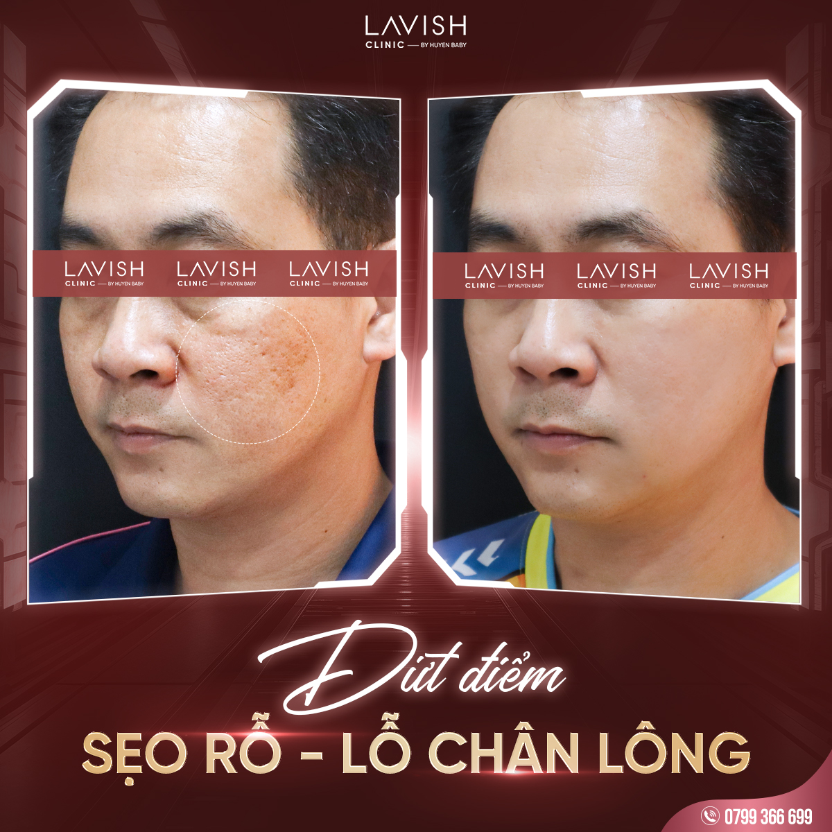 dieutriseolavishclinic