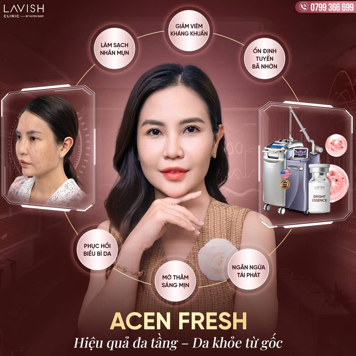 Phacdo_acenfresh_lavishclinic