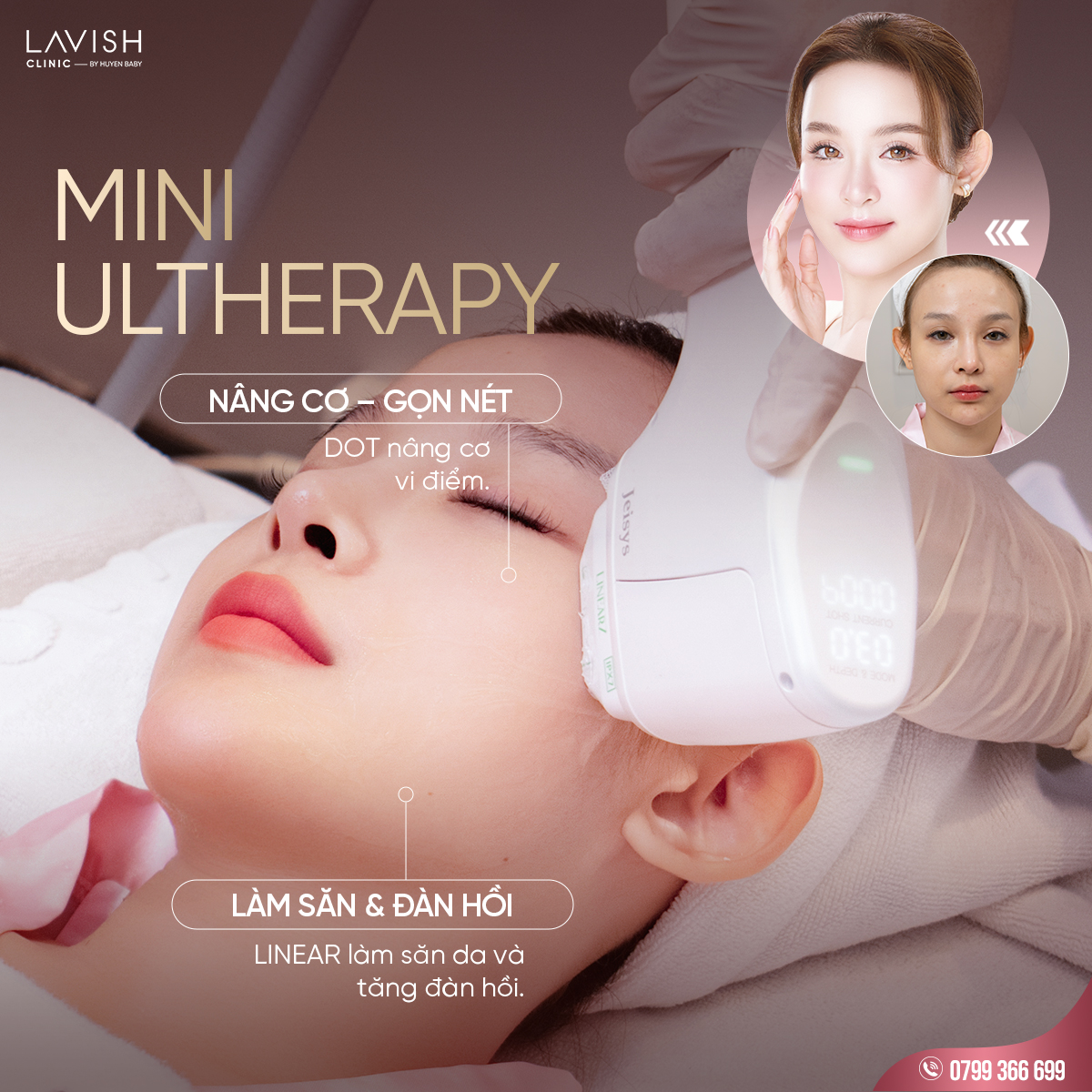 Trehoadatanglavishclinicbyhuyenbaby 