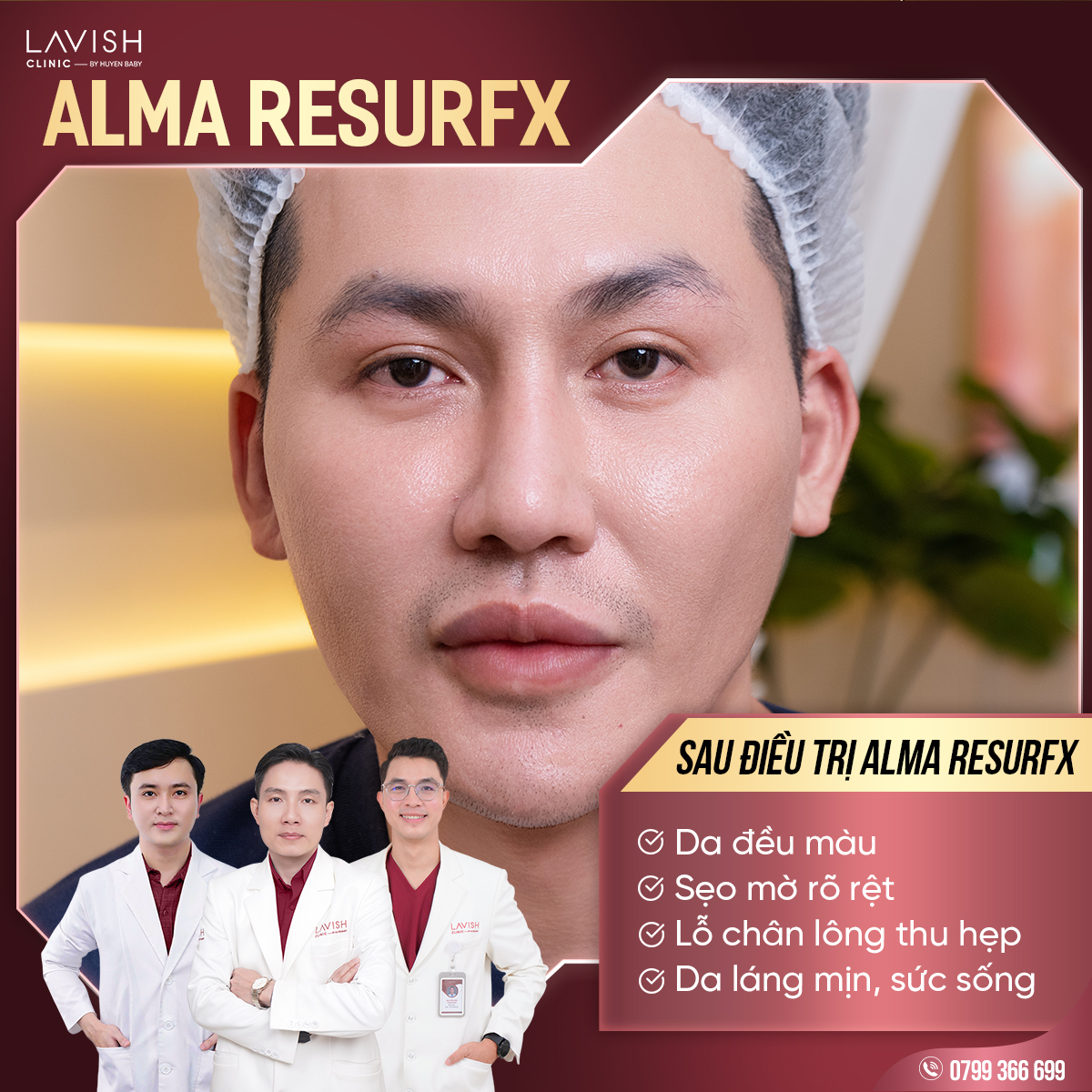 lavishclinictriseorohieuqua_almaresurfx