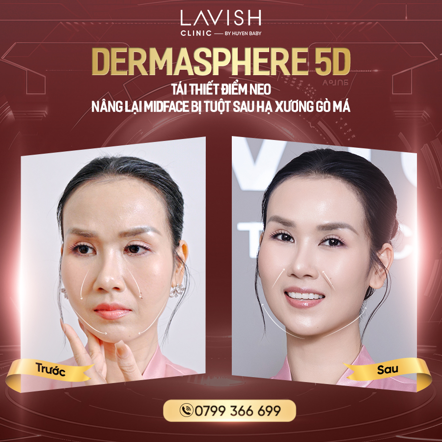 lavishclinic_nangcotrehoa