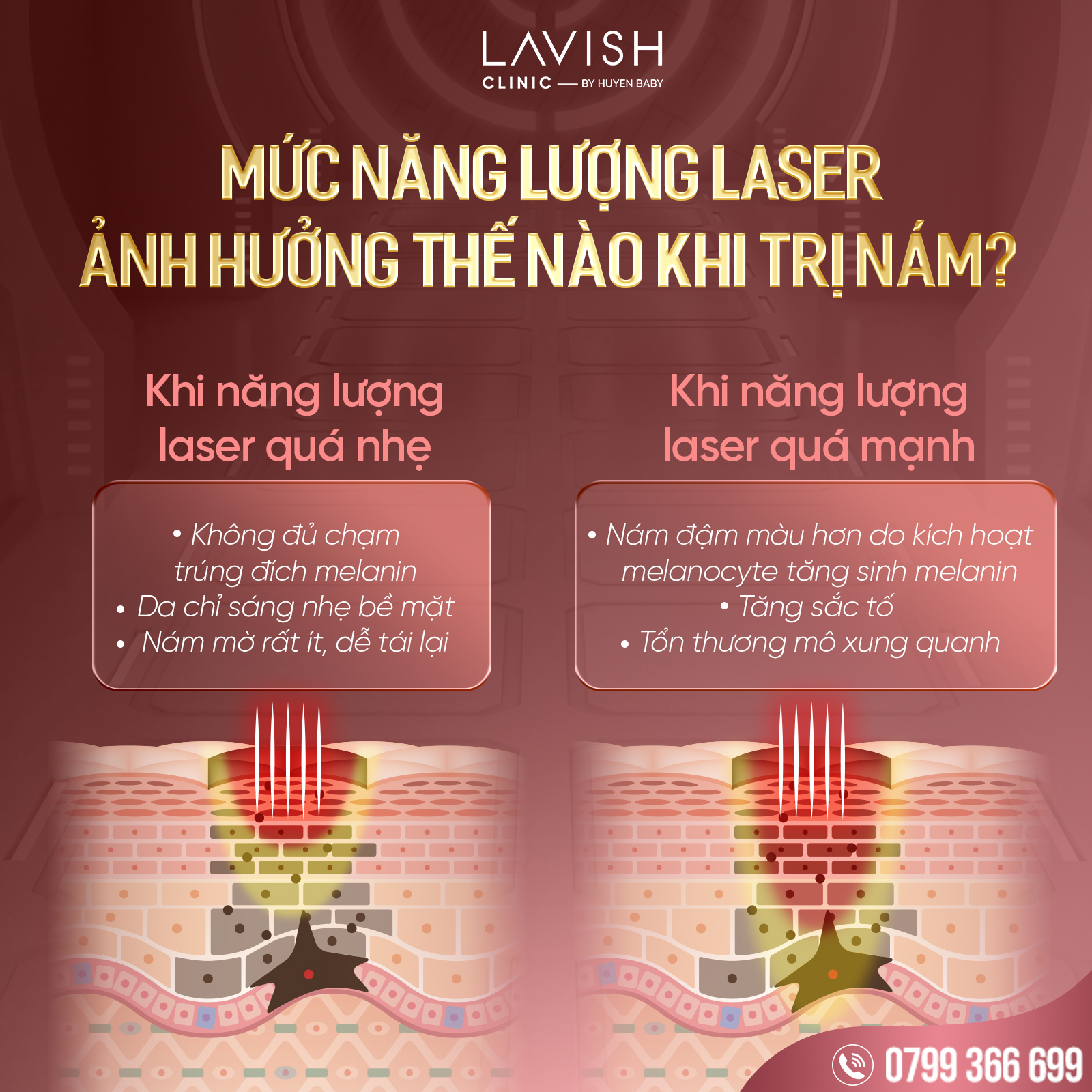 Trinamlaser_lavishclinicbyhuyenbaby