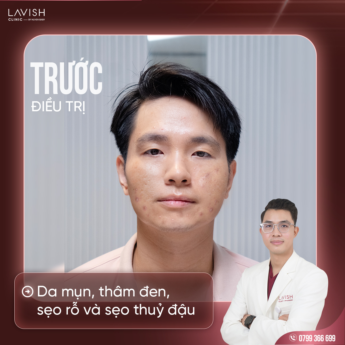 lavishclinic_triseorohieuqua