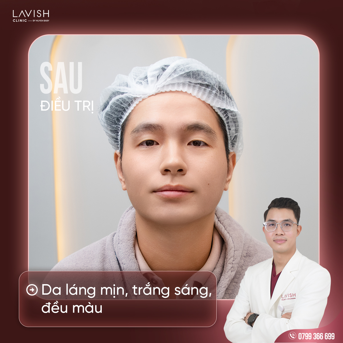 lavishclinic_triseorohieuqua