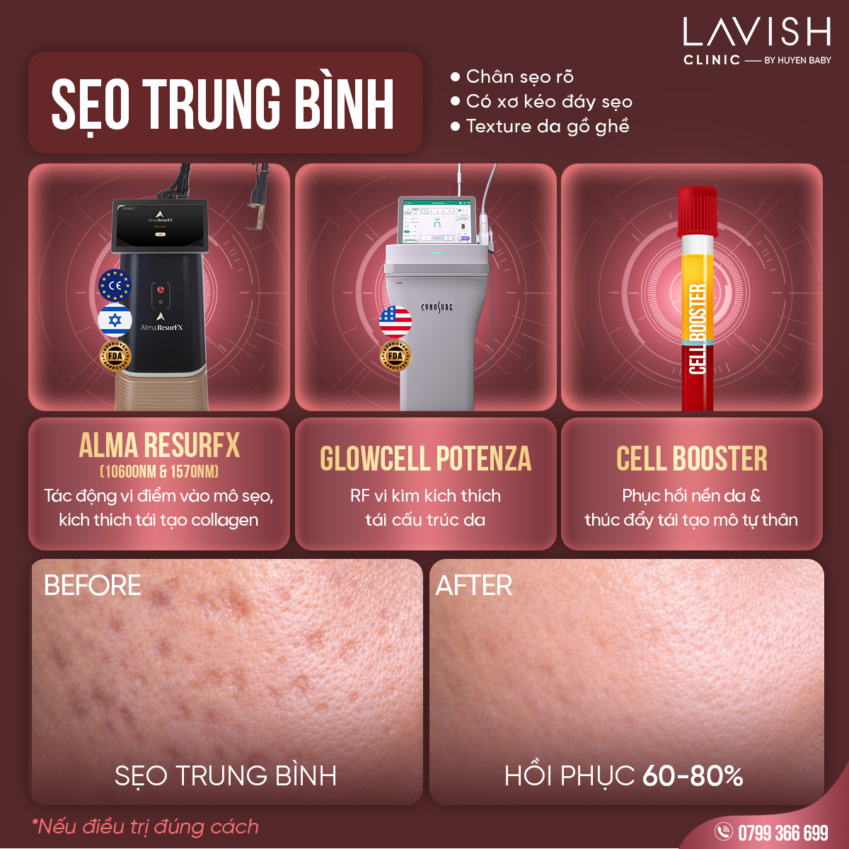Lavishclinic_triseorohieuqua