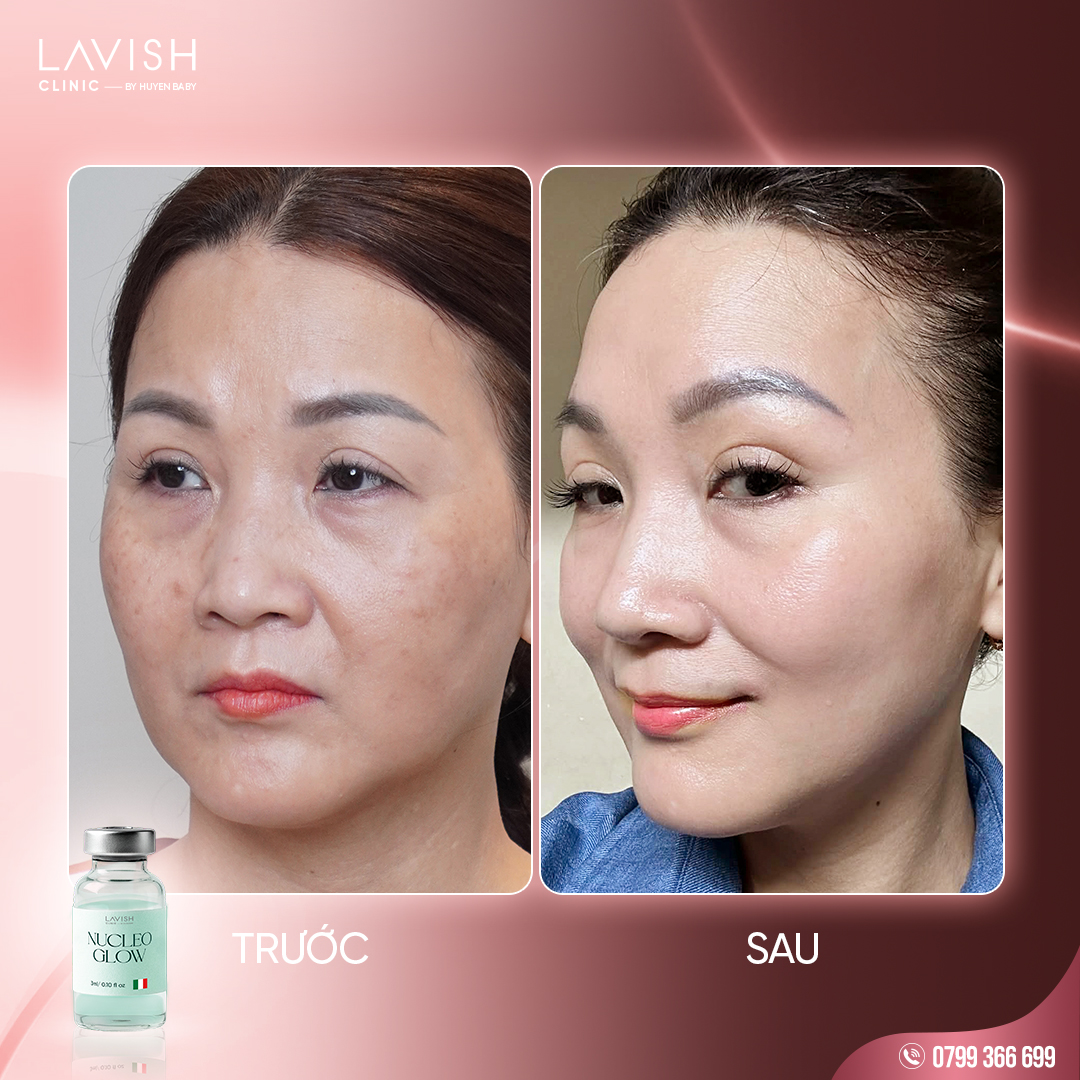 ruoc-sau-tai-sinh-da-nucleo-glow-lavish