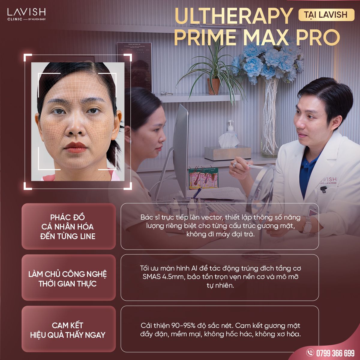 Ultherapyprime_lavishclinic_trehoahieuqua 