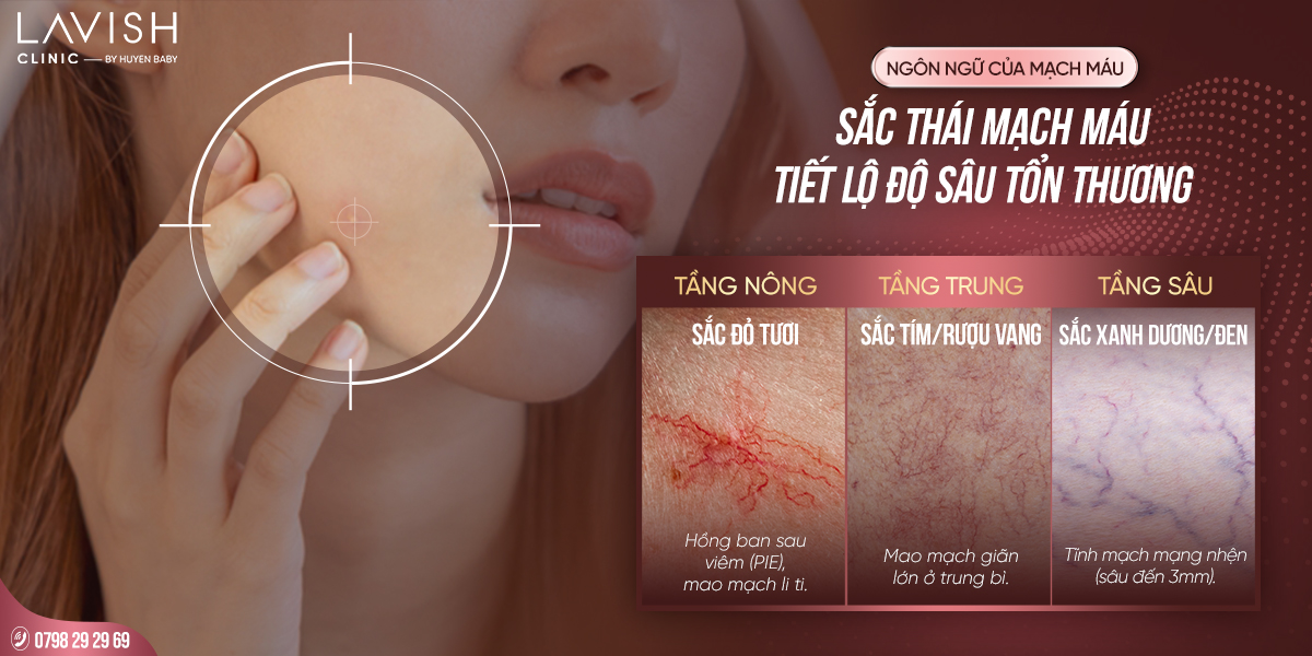 cong-nghe-harmony-ai-pro-tai-lavish-clinic