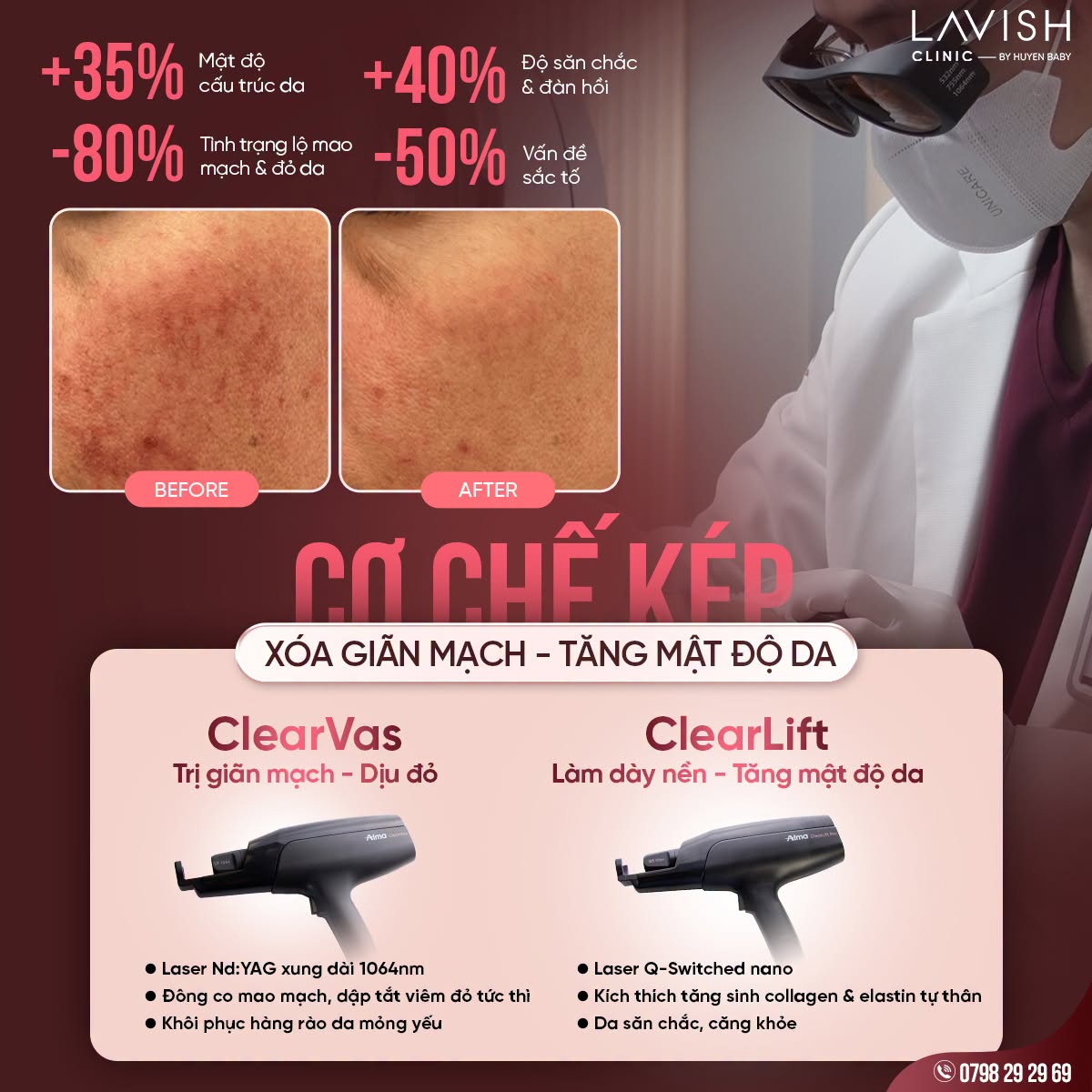 lavish-clinic-by-huyen-baby-alma-longevity-summit-2026.