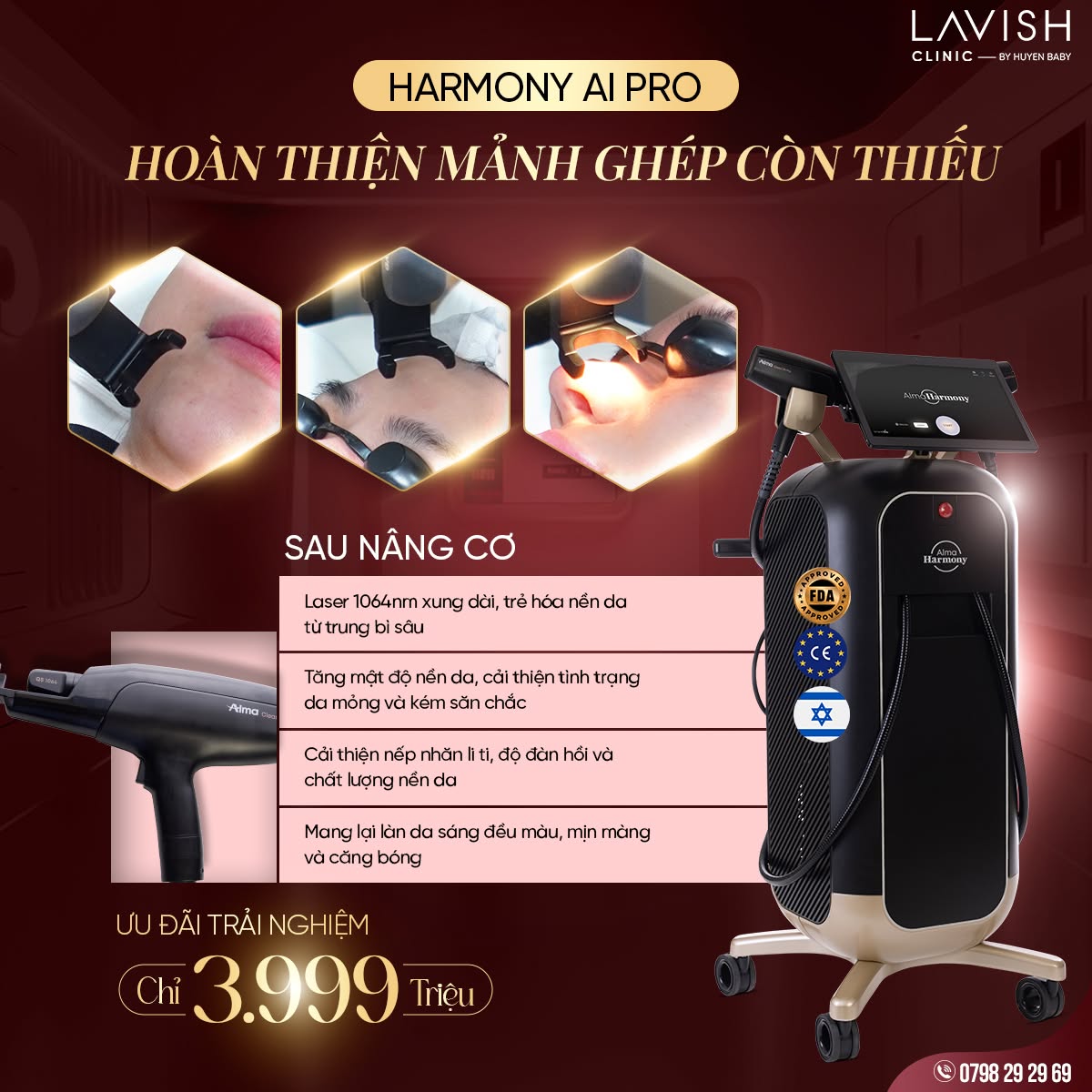 top1trehoaxoanhan_lavishclinicbyhuyenbaby