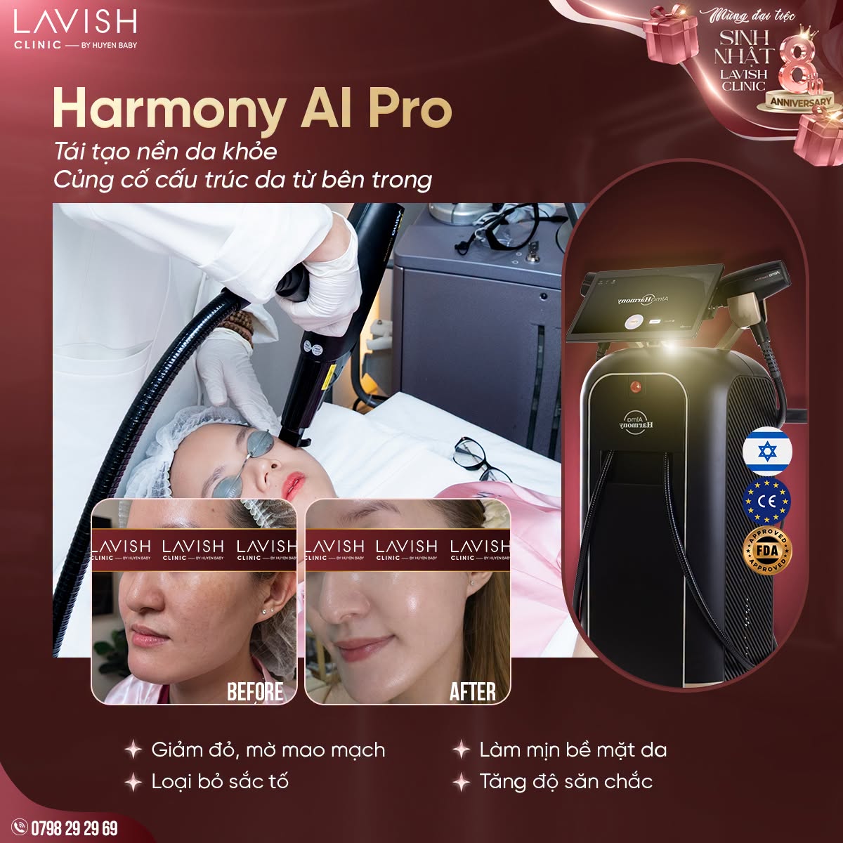 dieu-tri-gian-mao-mach-harmony-ai-pro.jpg