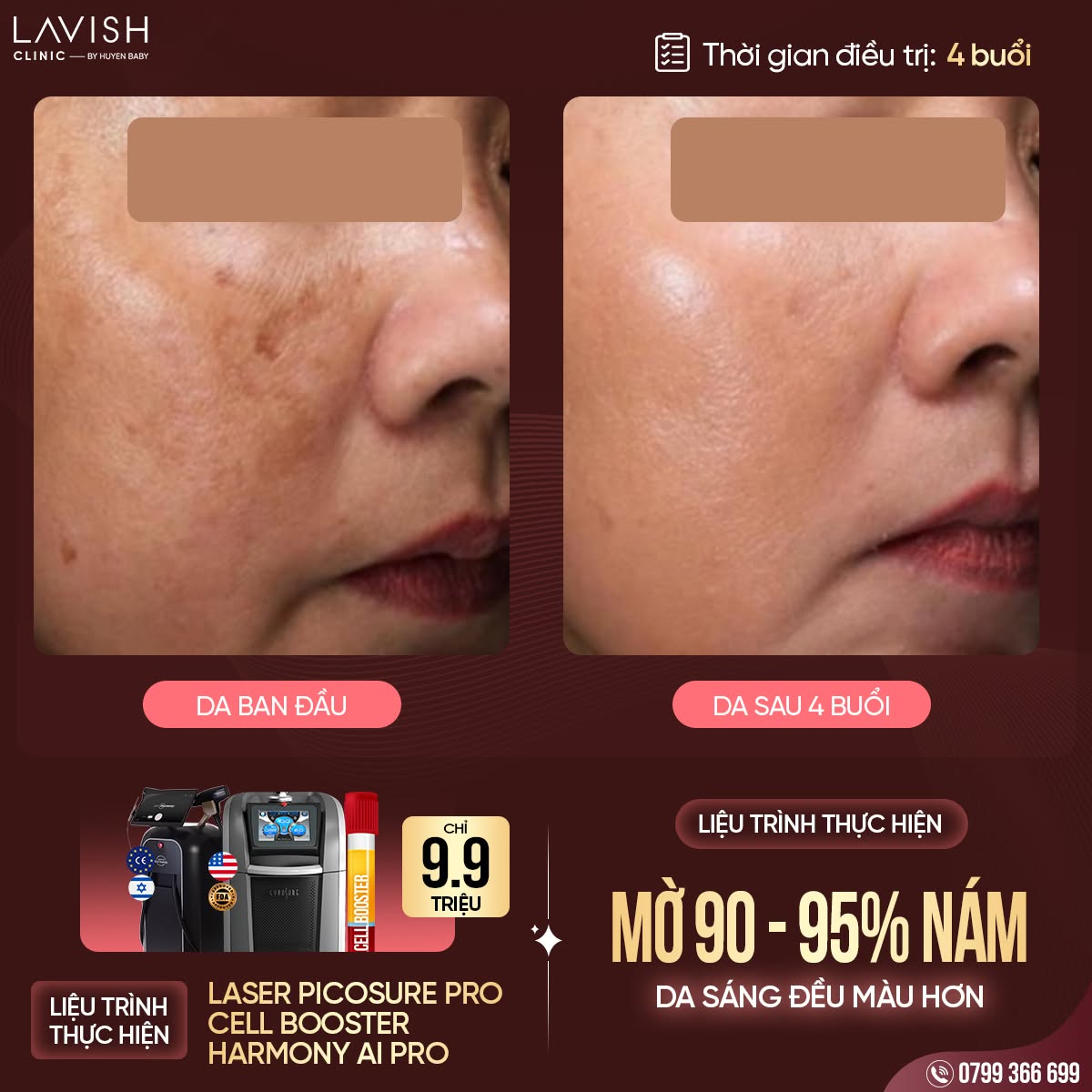 lavish-clinic-by-huyen-baby-sinh-nhat-8-nam-tri-an-khach-hang.jpg