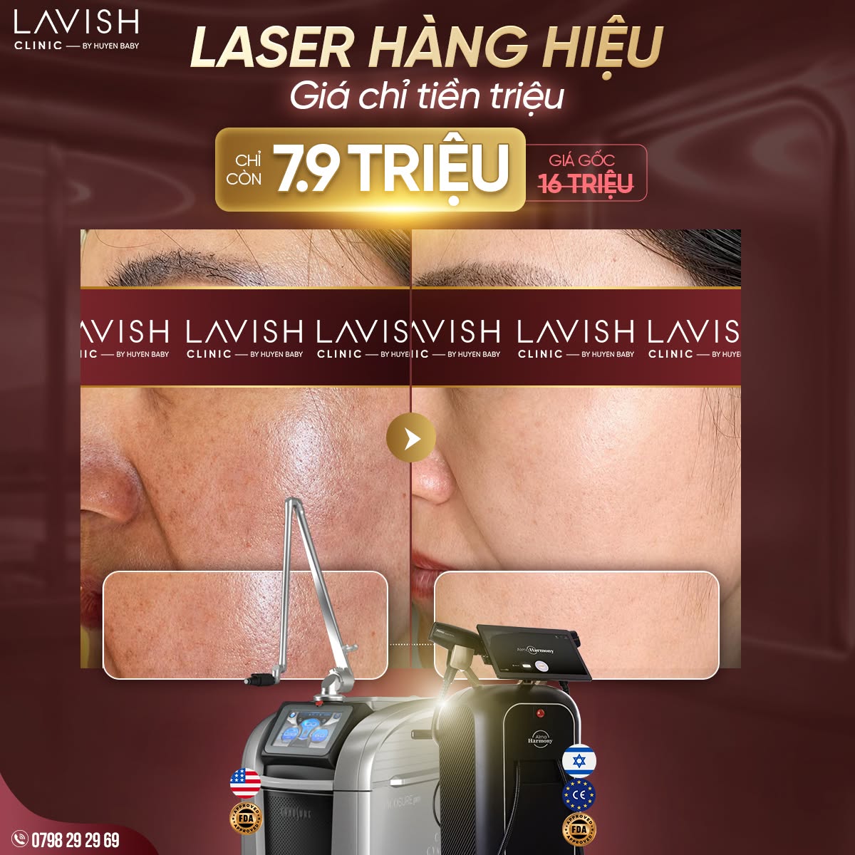 lavish-clinic-by-huyen-baby-sinh-nhat-8-nam-tri-an-khach-hang.jpg