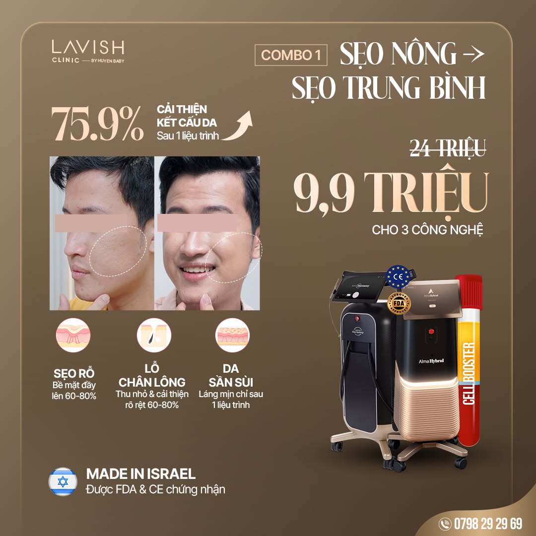 https://lavish.vn/lien-he/