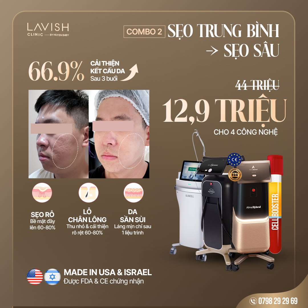 lavish-clinic-by-huyen-baby-dieu-tri-seo-ro-da-cong-nghe.