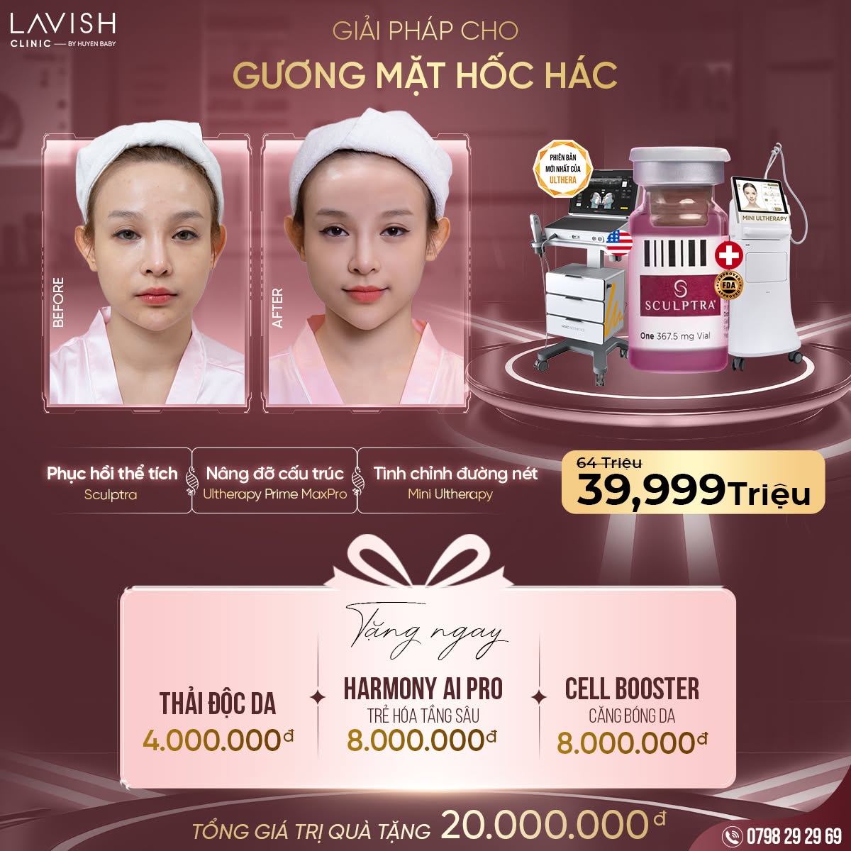 phac-do-baby-face-sculptra-ultherapy-prime