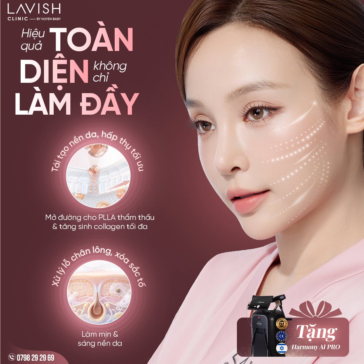 sculptra-lavish-clinic-by-huyen-baby