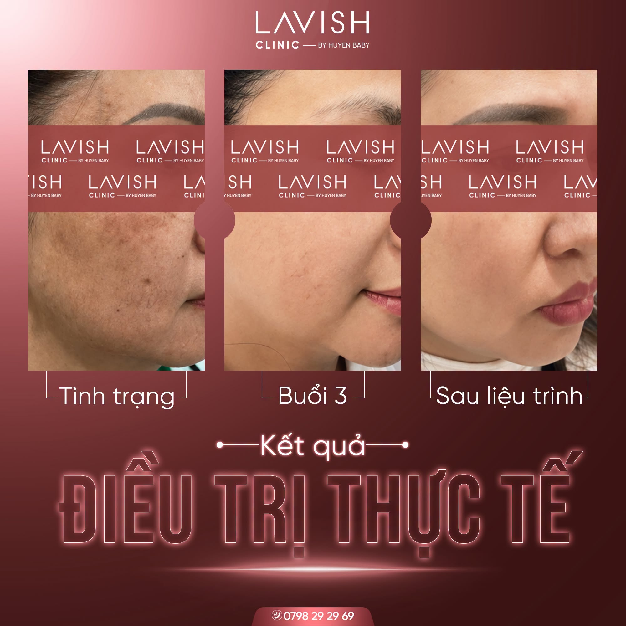 Q&A_trinamda_lavishclinicbyhuyenbaby