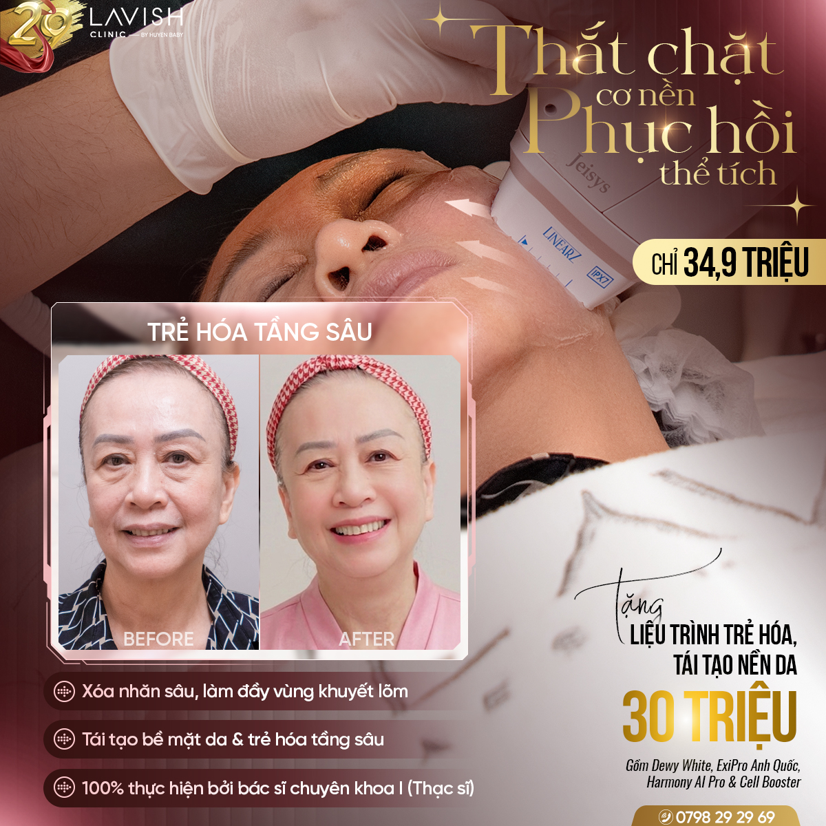 uudaitrehoa_vietkieu_lavishclinic